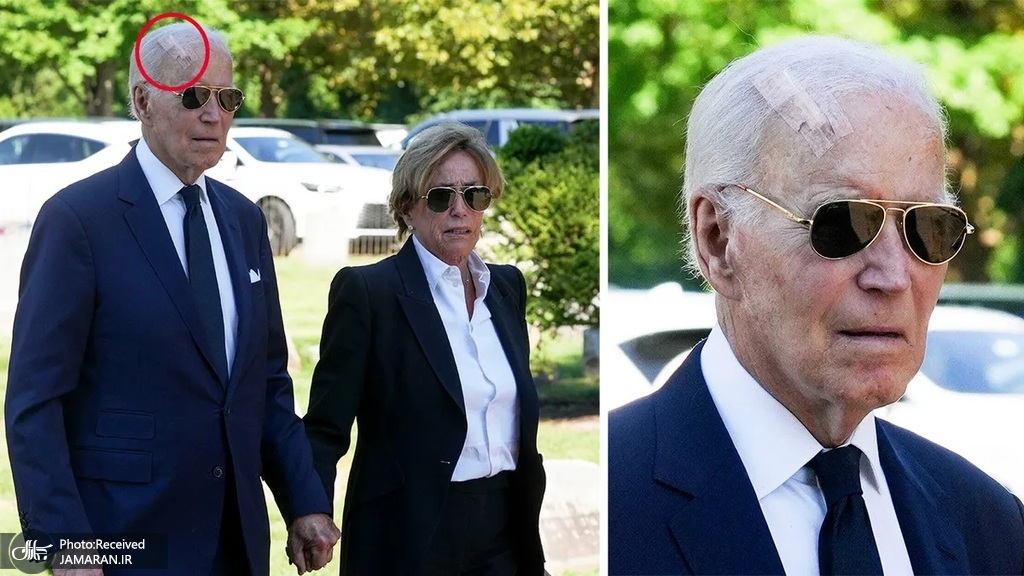 ماجرای زخم بزرگ روی سر جو بایدن (1)