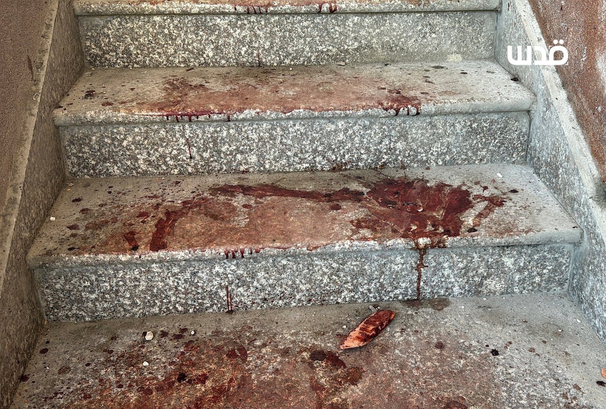 تصویری از محل جنایت ارتش اشغالگر در خان یونس 2