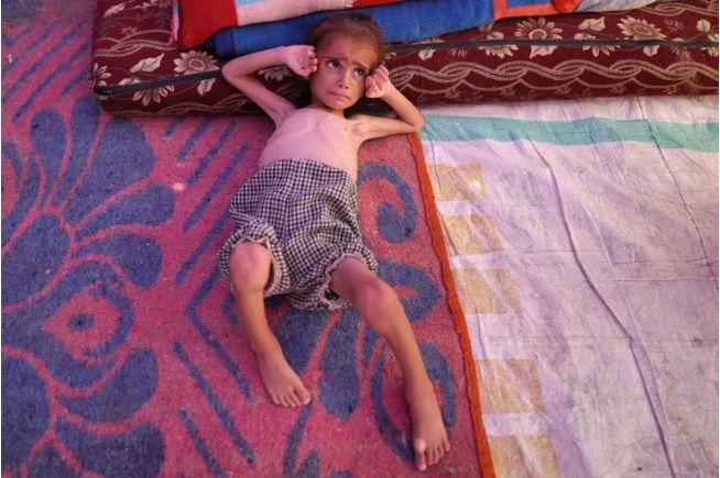 humanitarian crisis،Palestinian children،Hungry children of Gaza،Israeli genocide in Gaza