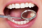 دندان‌ها می‌توانند خود را ترمیم کنند؟