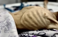 شهادت کودک فلسطینی بر اثر گرسنگی در جنوب غزه (5)
