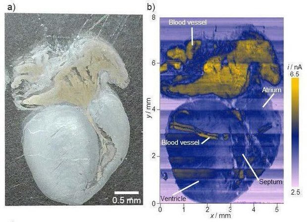 تشخیص بافت های سرطانی با کمک جریان الکتریکی!