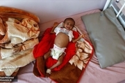 اوضاع وخیم کودکان یمنی