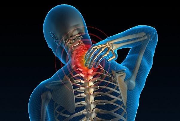 
چه زمانی برای گردن درد نزد پزشک برویم؟