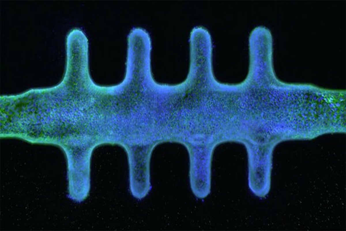 ساخت روده انسان روی تراشه!