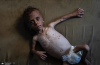 عکس‌های دلخراش از غزه (5)