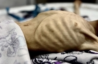 شهادت کودک فلسطینی بر اثر گرسنگی در جنوب غزه (2)
