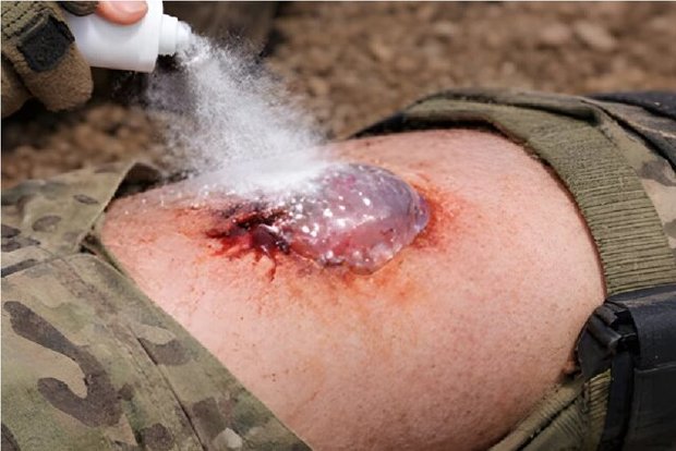 توقف یک ثانیه‌ای خونریزی ممکن شد
