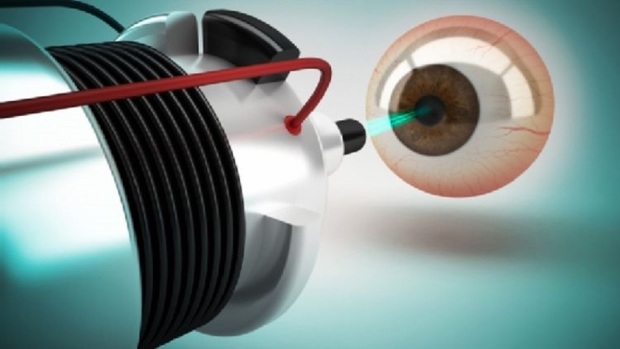 درمان نقص اختلال بینایی با برش قرنیه آستیگماتیک
