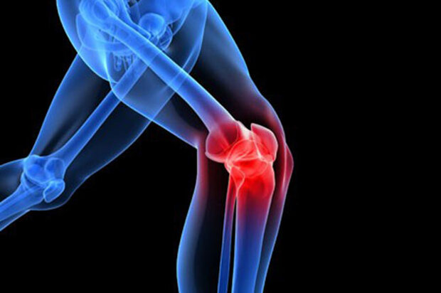 آنچه باید درباره تزریق ژل در زانو بدانید