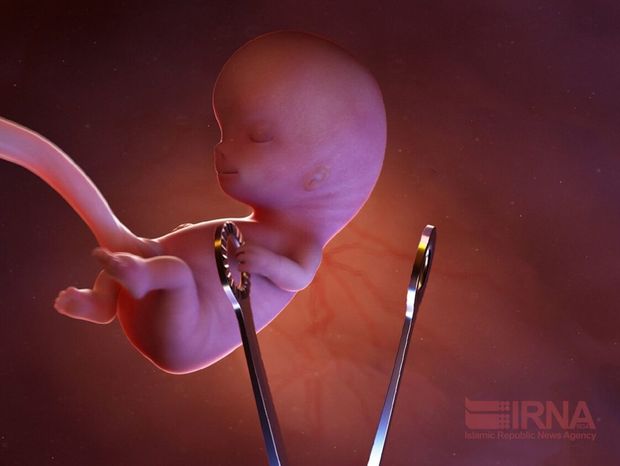 ۱۳۷ مجور سقط جنین در لرستان صادر شد
