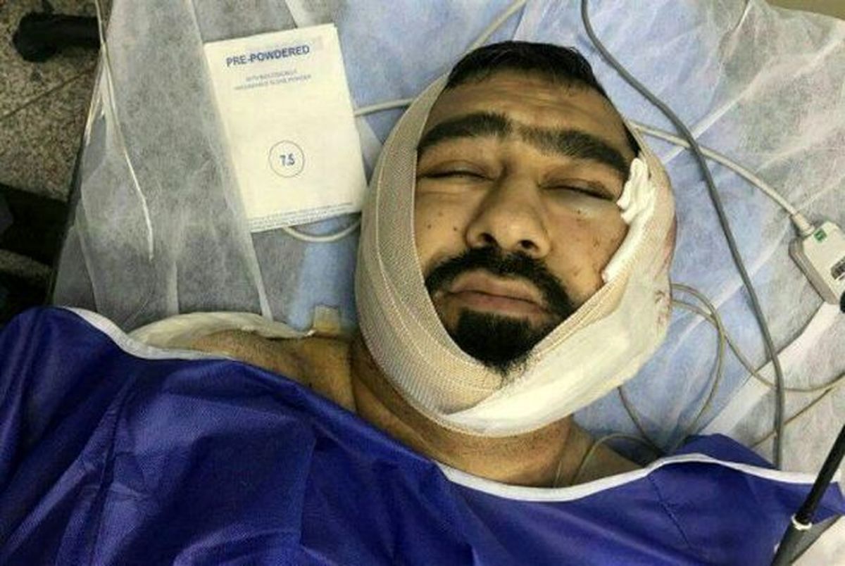 توضیحات پلیس درباره حمله به یک روحانی در تهران