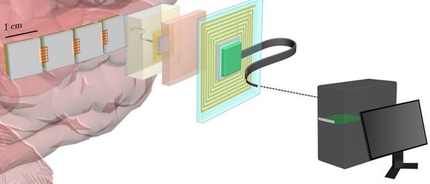 بازیابی گفتار ، بینایی و حرکت با کمک مودم مغزی

