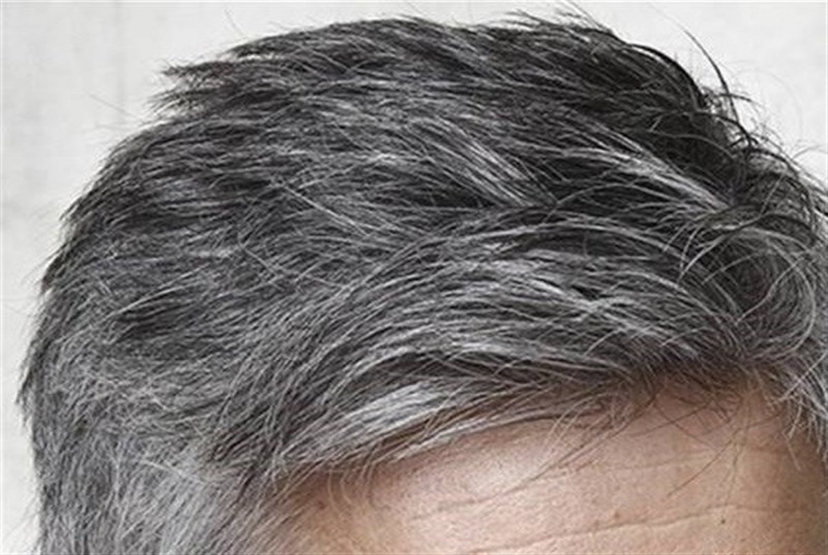 پیشگیری از سفیدی مو با مصرف این مکمل‌ها