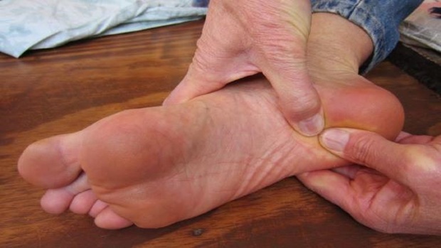 
چند راهکار ساده برای درمان خارپاشنه