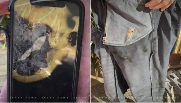 انفجار آیفون ایکس در جیب یکی از کاربران
