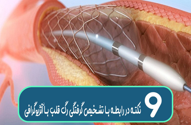 آنژیوگرافی قلب و تشخیص گرفتگی رگ‌ های قلب؛ هر آنچه باید بدانید