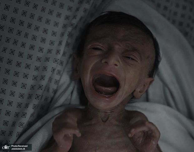 سه فلسطینی دیگر در غزه بر اثر گرسنگی به شهادت رسیدند