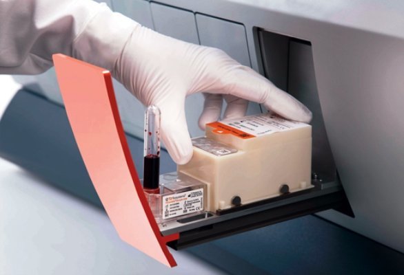 عفونت خون در پنج ساعت تشخیص داده می شود