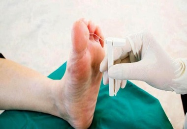 فناوری مدرن برای درمان زخم و پای دیابتی
