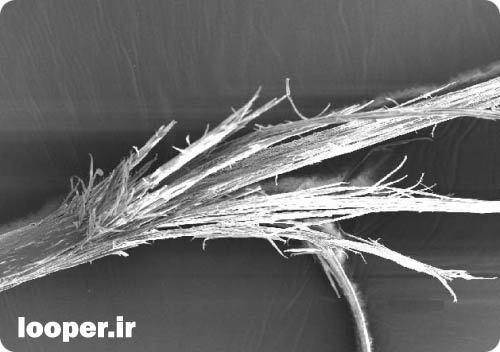 موخره را اینگونه درمان کنید