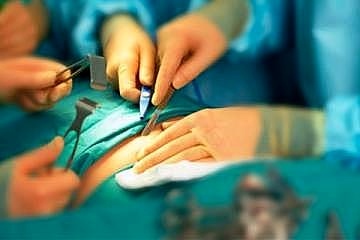 هشدار نسبت به انجام عمل‌های زیبایی در اتاق عمل‌های غیر استاندارد  وقوع موارد فوت به دلیل جراحی‌های غیر قانونی
