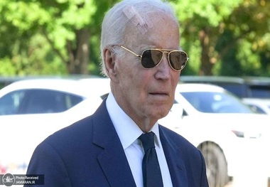 ماجرای زخم بزرگ روی سر جو بایدن! + عکس