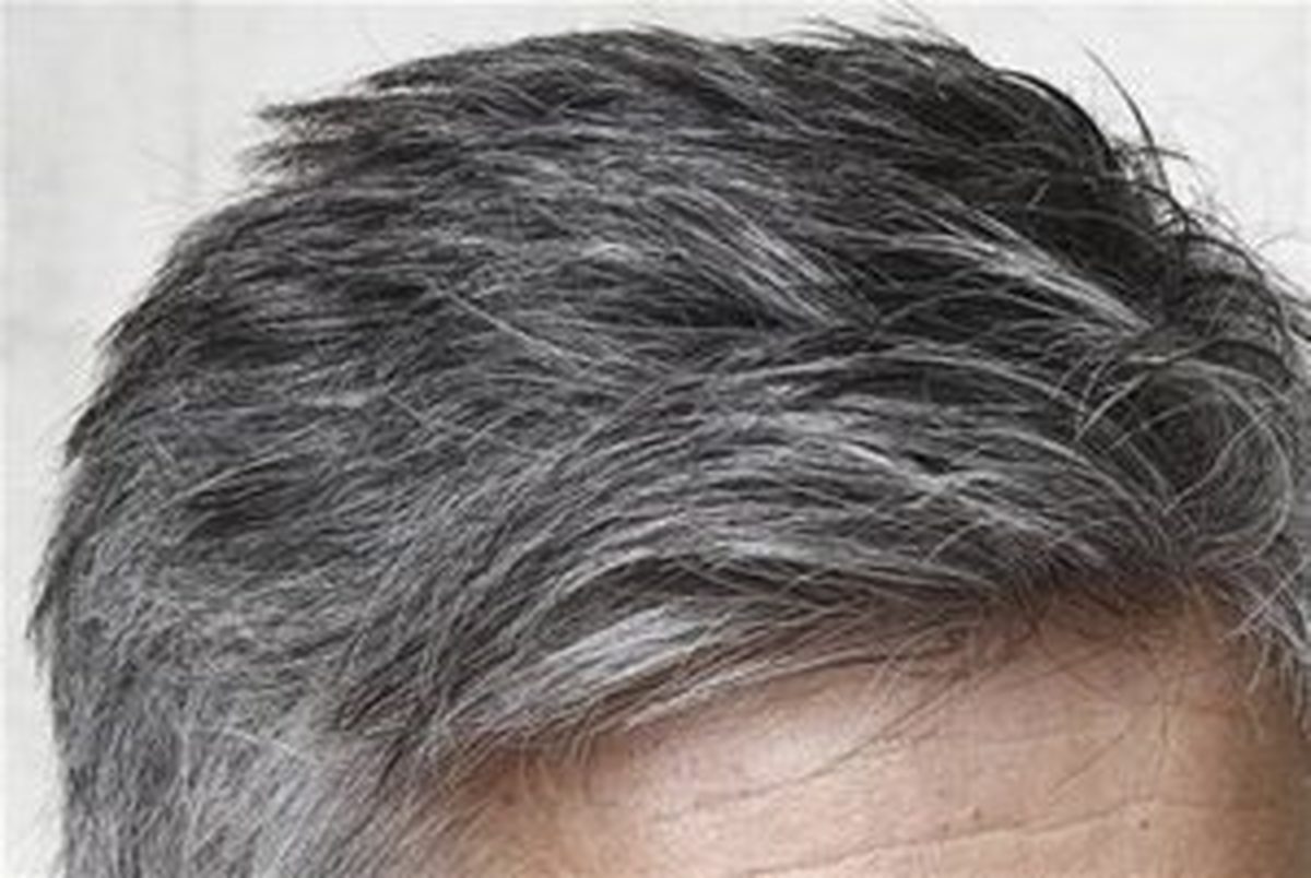 بررسی عوامل سفید شدن مو