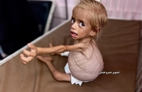 شام قدیح، کودک دو ساله فلسطینی (8)