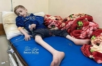 وضعیت وحشتناک کودک فلسطینی به خاطر قحطی در غزه (1)