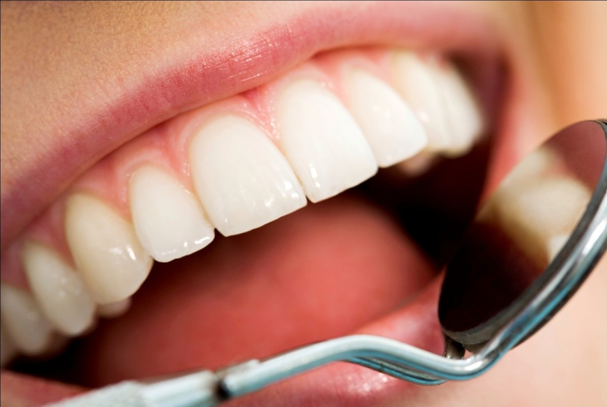 دندان‌های پوسیده با چه ماده‌ای پر می‌شوند؟