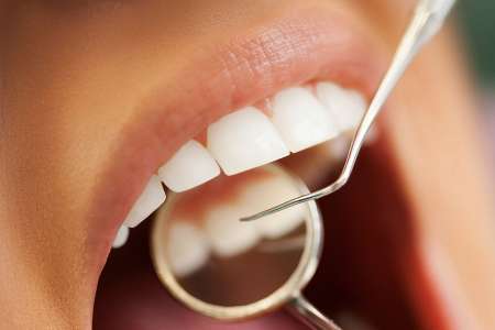 ارائه خدمات دندانپزشکی به دانش آموزان زیر14سال کهگیلویه
