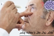 ارتباط بین سلامت چشم و بیماری آلزایمر در سالمندان