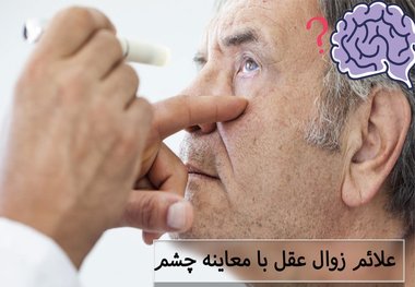 ارتباط بین سلامت چشم و بیماری آلزایمر در سالمندان