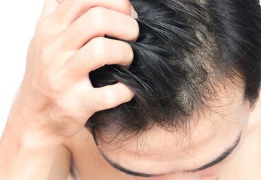اگزمای پوست سر چیست و چطور درمان می‌شود؟