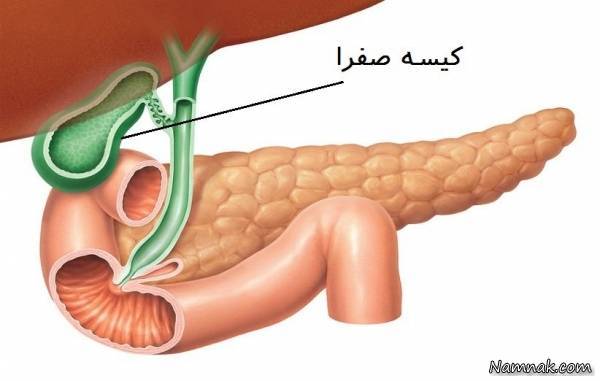  سنگ صفرا چگونه ایجاد می‌شود؟