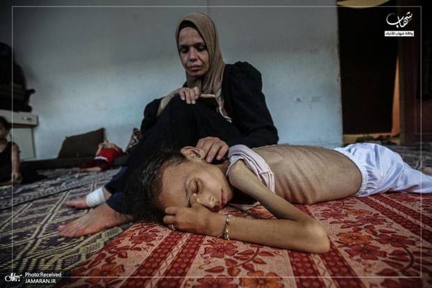 دختر فلسطینی دیگر نمی تواند راه برود + عکس