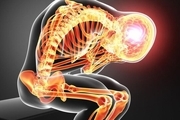 کاهش فعالیت مراکز ایجاد درد در بدن توسط دانشمندان