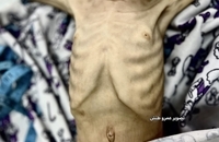 شهادت کودک فلسطینی بر اثر گرسنگی در جنوب غزه (7)