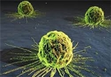 علائم سرطان های دستگاه گوارش را بشناسیم