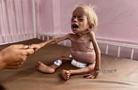 شام قدیح، کودک دو ساله فلسطینی (9)