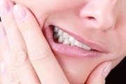 
آنچه باید درباره دندان قروچه بدانید