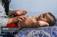 زخم های هانیه (7)