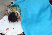 مصدومیت شدید مرد جوان بر اثر سقوط بالابر در دزفول