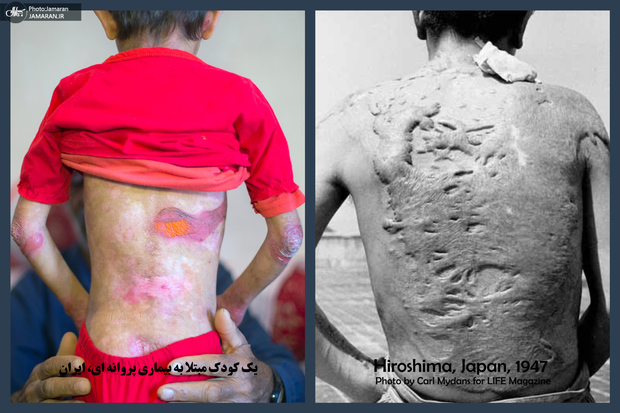 از هیباکوشا تا قربانیان تحریم: رنج، تاب‌آوری و امید