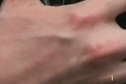 پوست دست انسان زیر میکروسکوپ