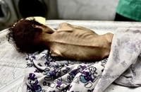 شهادت کودک فلسطینی بر اثر گرسنگی در جنوب غزه (3)