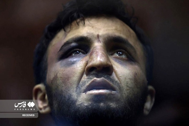 وضعیت عجیب 4 متهم حمله تروریستی مسکو در دادگاه + عکس ها