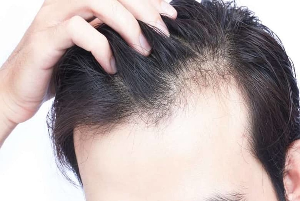 مصرف این ویتامین برای درمان ریزش مو و مشکلات پوستی