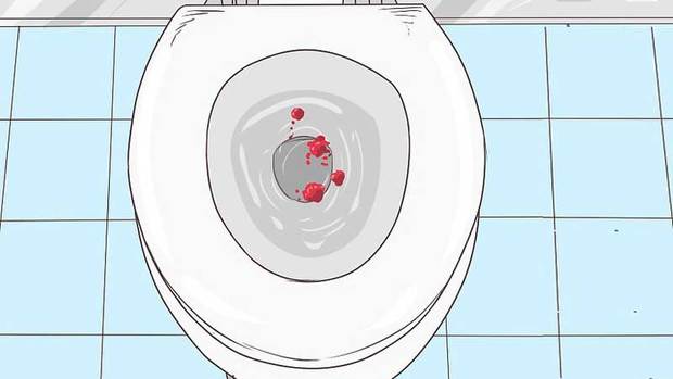 شرایطی که باعث خونریزی مقعدی می‌شود

